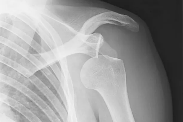 Dislocation Major